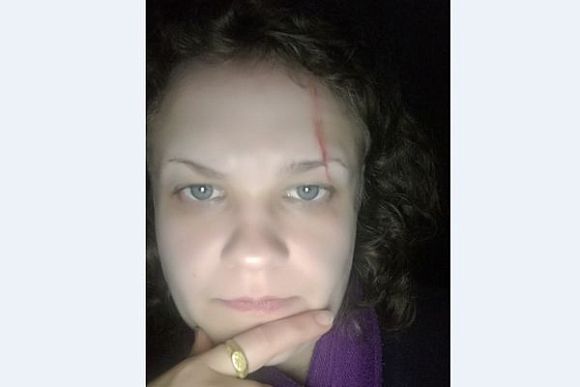 Пензенский журналист рассказала о совершенном на нее нападении
