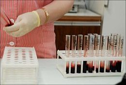 В Пензенской области проживает почти 1,5 тыс. ВИЧ-инфицированных В Пензенской области проживает почти 1,5 тыс. ВИЧ-инфицированных