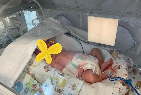 В Пензе врачи вернули зрение трем недоношенным детям