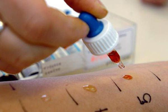 5 марта в пензенской горбольнице №4 будут принимать аллергологи-иммунологи