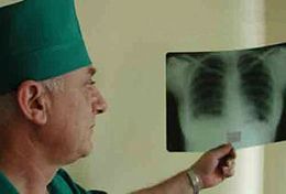Ежегодно в Пензенской области туберкулезом заболевает более 600 человек
