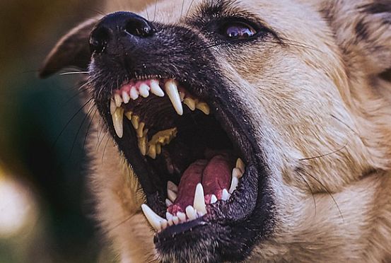 Администрация Заречного выплатит 30 тыс. рублей укушенной собакой девочке