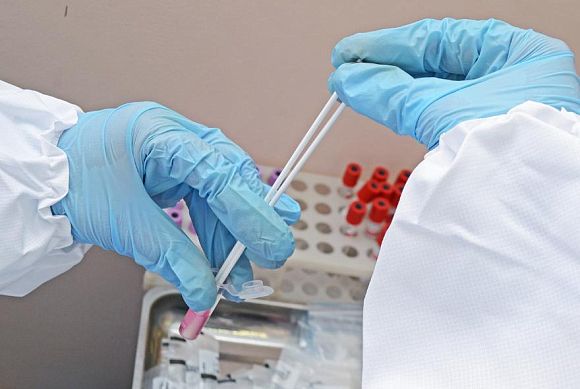 В Пензенской области подтвердилось 597 новых случаев заболевания коронавирусом