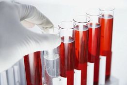 В Пензе стали известны результаты анализов студента-нигерийца В Пензе стали известны результаты анализов студента-нигерийца