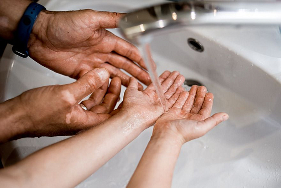 Жителей Арбеково предупредили об отключении воды