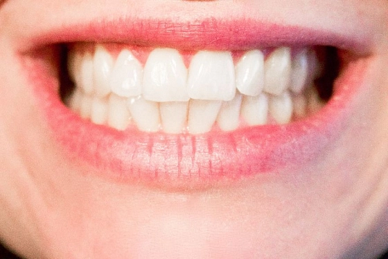 Пензенский стоматолог назвала привычки, которые опасны для зубов