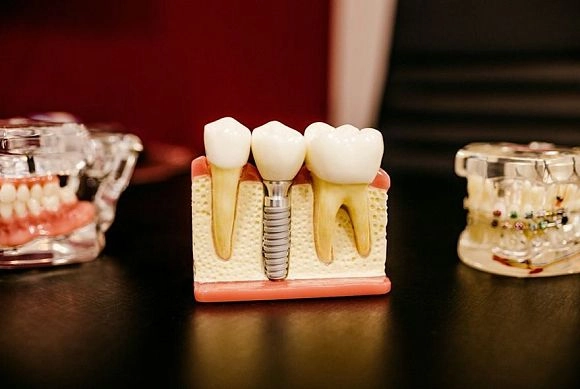 Стоматолог из Пензы рассказала, как алкоголь влияет на здоровье зубов